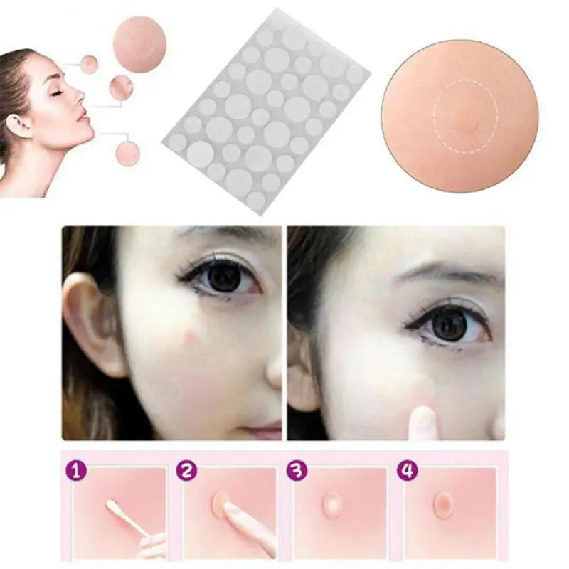 36Pcs Acne Puistje Patch Stickers Acne Behandeling Puistje Remover Tool Smet Spot Huidverzorging Waterdichte Stickers Beauty