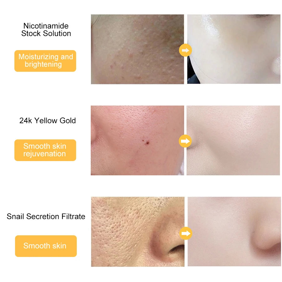 LAIKOU 24k Gold Face Serum Whitening Essence Cream Hyaluronic Acid Serum Moisturizer Day Creams Anti Aging Anti Wrinkle SkinCare