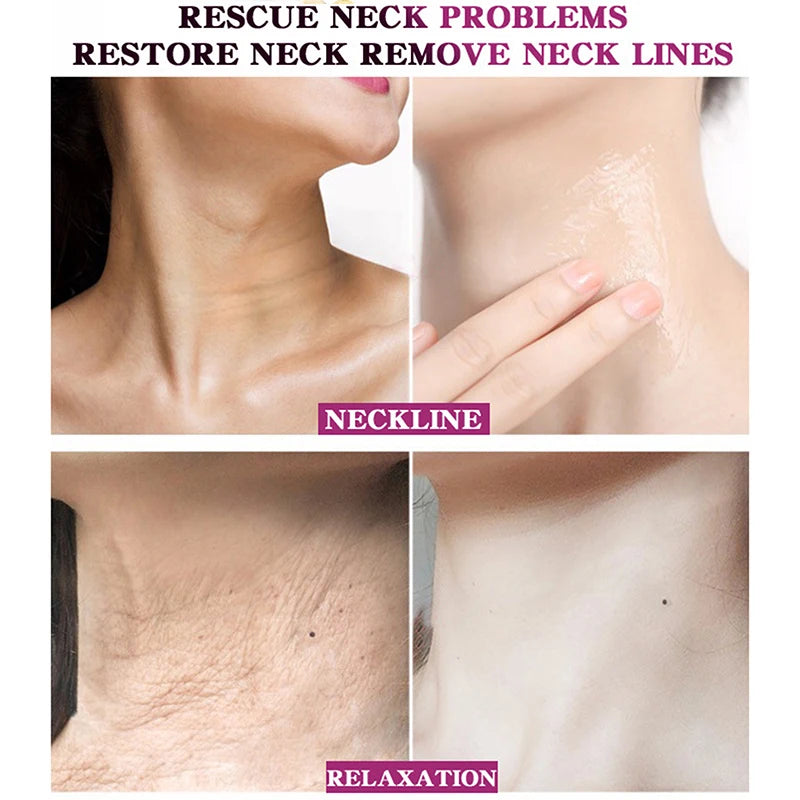 RtopR Neck Firming Wrinkle Remover Cream Rejuvenation Firming Skin Whitening Moisturizing Shape Beauty Neck Skin Care Products