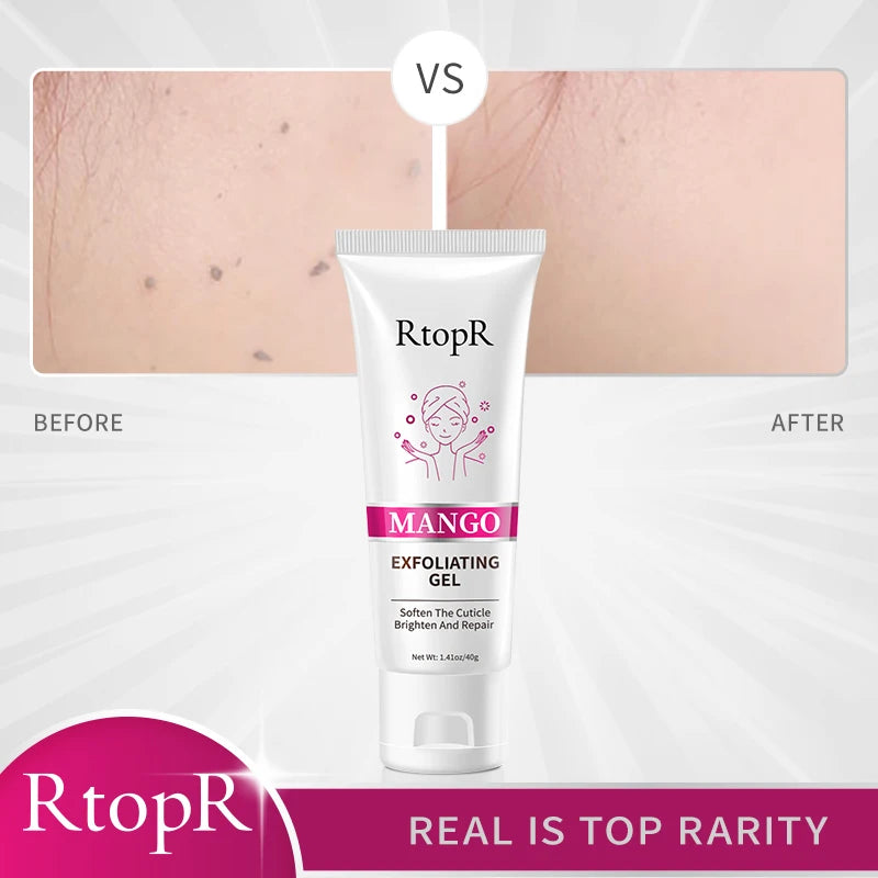 Facial Exfoliating Gel Skin Care Whitening Moisturizing Repair