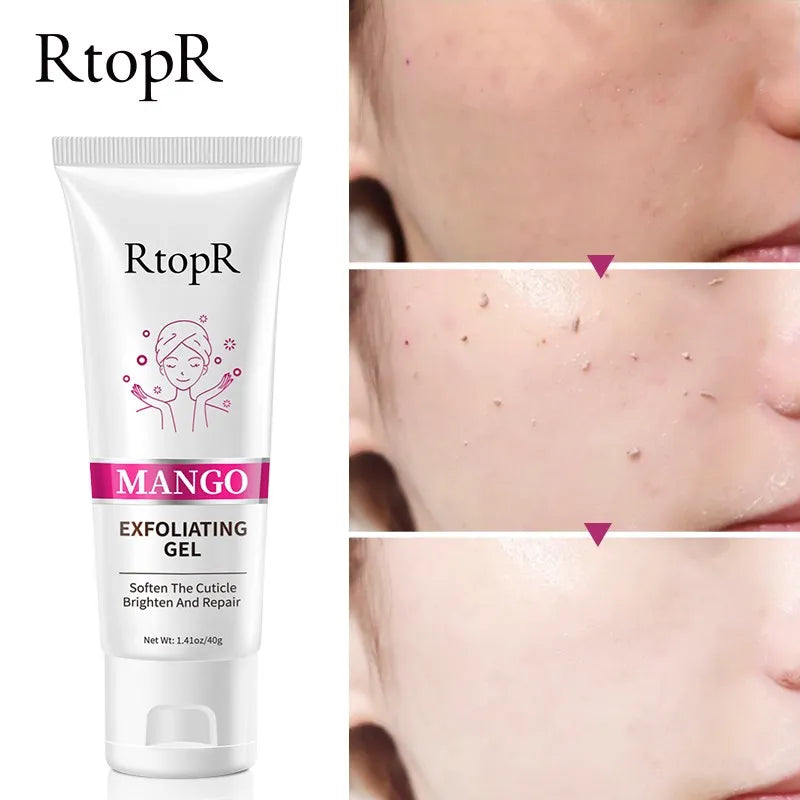 Facial Exfoliating Gel Skin Care Whitening Moisturizing Repair