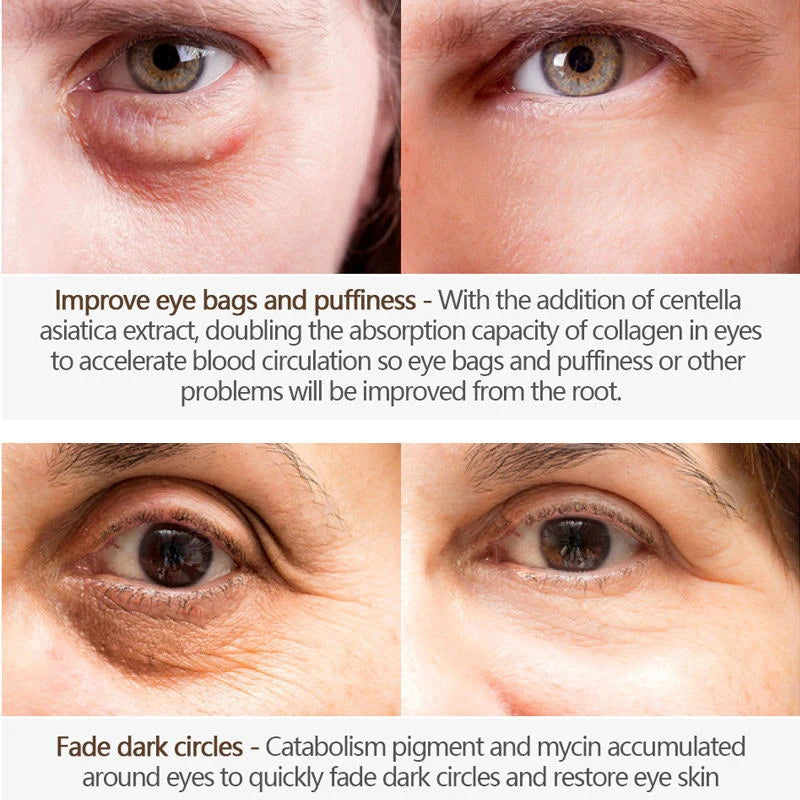 20g Magic Anti-Age Eye Cream Eye Serum Reduce Dark Circles Puffiness Under Eye Bags Wrinkles Eye Care Skin Care Products