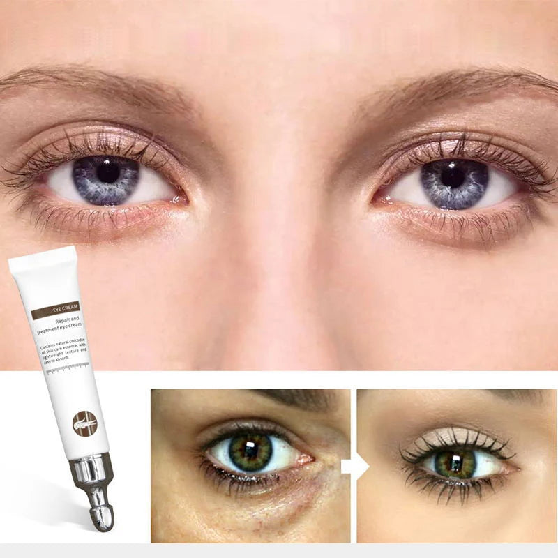 20g Magic Anti-Age Eye Cream Eye Serum Reduce Dark Circles Puffiness Under Eye Bags Wrinkles Eye Care Skin Care Products