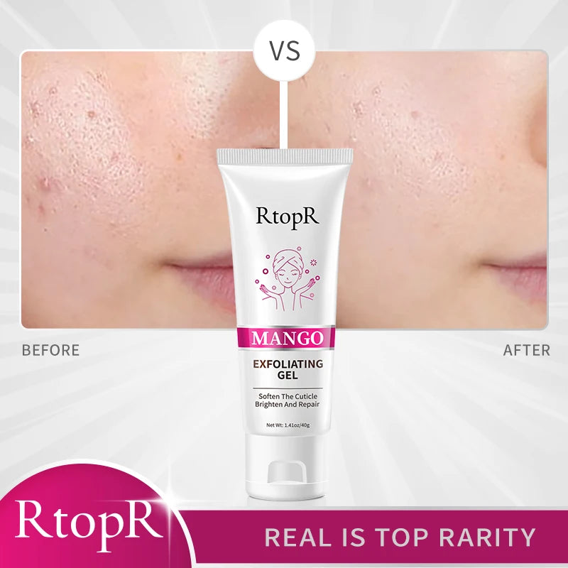 Facial Exfoliating Gel Skin Care Whitening Moisturizing Repair