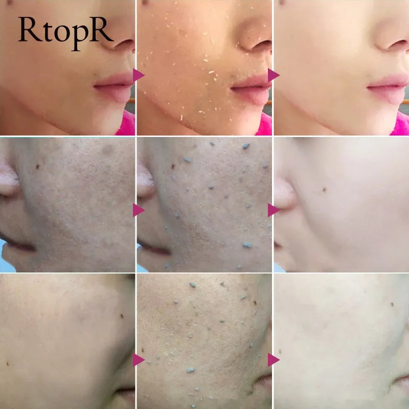 Facial Exfoliating Gel Skin Care Whitening Moisturizing Repair