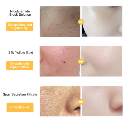 LAIKOU 24k Gold Face Serum Whitening Essence Cream Hyaluronic Acid Serum Moisturizer Day Creams Anti Aging Anti Wrinkle SkinCare