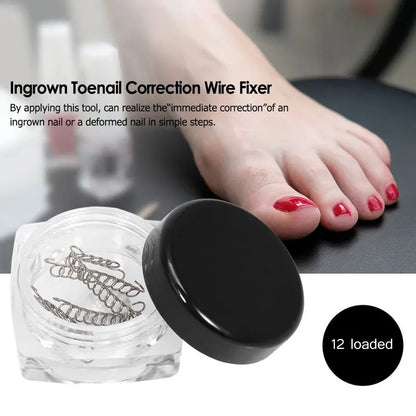 Tcare 1Set Fixer Pedicure Recover Ingrown Toenail Correction Wire Fixer Ingrown Toe Corrector Pedicure Treatment Foot Care Tool