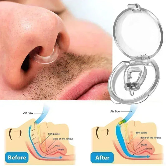 Anti-Snoring Corrector Snore Prevention Gadget Women's Anti-Snore Device Snore Elimination Nose Clip Men's Sleep Night